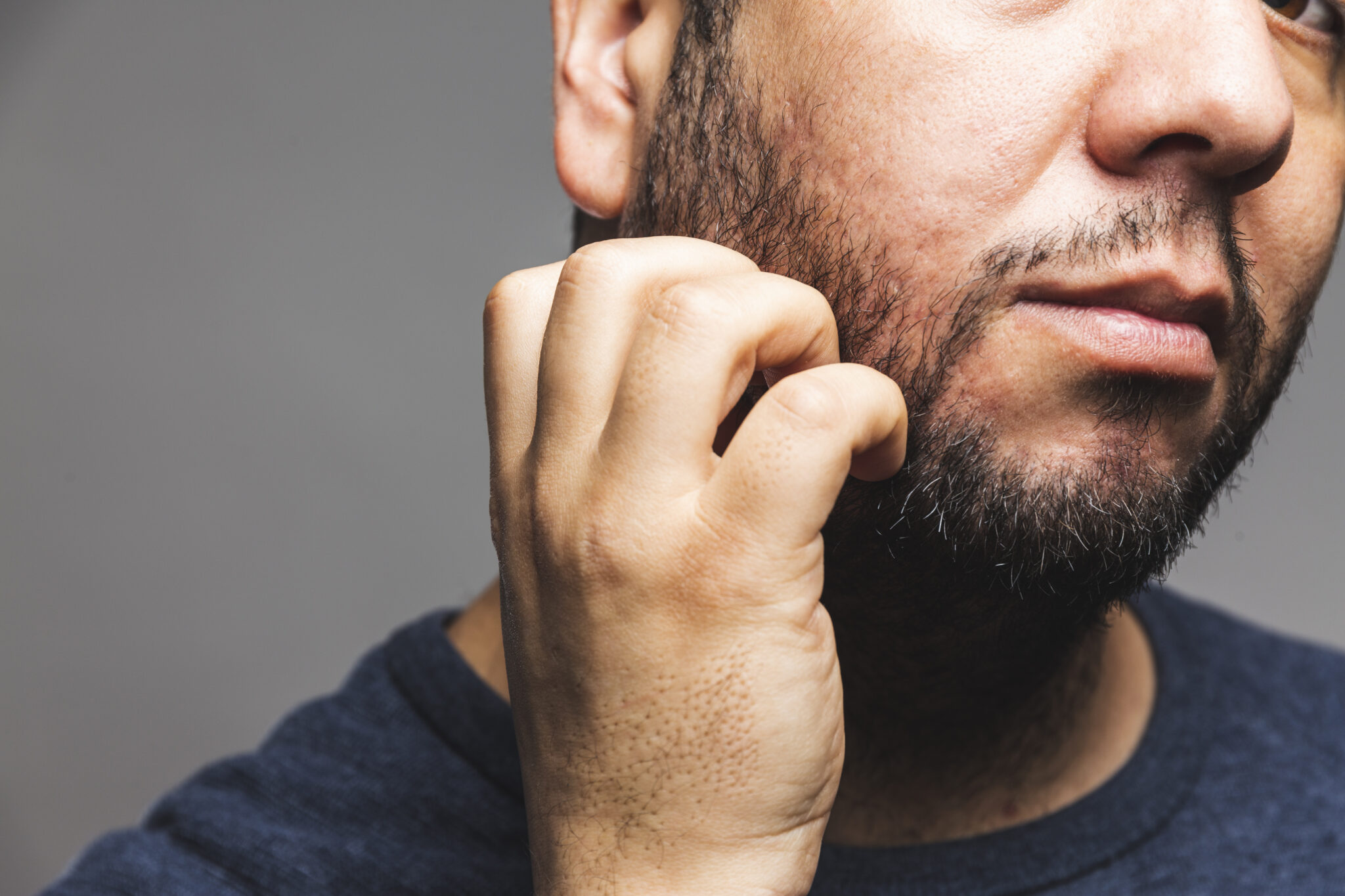 Barbe qui gratte